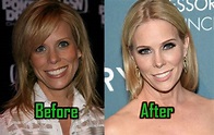 Cheryl Hines Plastic Surgery: Facelift, Boob Job, Before After ...