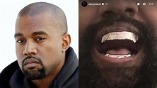 Kanye West replaced his teeth with $850k James Bond-inspired Titanium ...