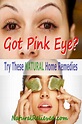 Natural Pink Eye Remedy To Keep It From Spreading - NaturalRelieved