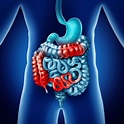 Intestinal Obstruction - Factors, Types and Treatment