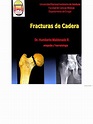 Fracturas de Cadera | PDF