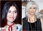 Emmylou Harris Plastic Surgery Before And After Botox, Nose Job Rumors