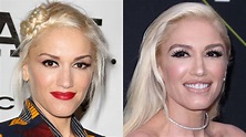 Gwen Stefani Had Multiple Plastic Surgery Procedures, Experts Believe
