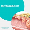 O que é Carcinoma In Situ? | Dra Sabrina Chagas