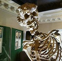 The Fascinating Skeleton of Joseph Merrick