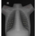 The constructed pediatric chest phantom: (a) the completed phantom; (b ...
