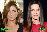 Sandra Bullock Plastic Surgery Speculations Sparked By Oscar Appearance