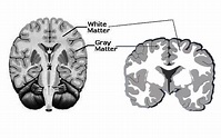 Neuroanatomy, Gray Matter - StatPearls - NCBI Bookshelf