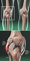 Lateral Collateral Ligament (LCL) Injury | Central Coast Orthopedic ...