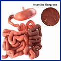 Small Intestine Disease - Best Gastroenterology Hospital in India