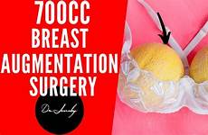 700cc breast augmentation implant surgery