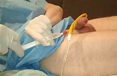catheter removal videos
