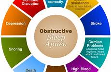 sleep apnea effects undiagnosed prevention health exam physical danger read dental