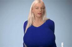 breast implants botched