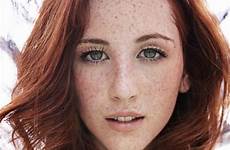 redheads visit hot freckles
