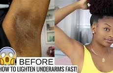 dark underarms lighten skin armpits armpit hair naturally whiten lightening whitening fast months growth choose board top rash