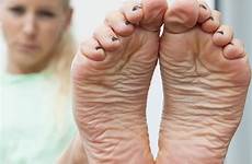 soles arches barefoot