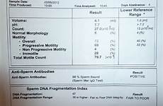 analysis semen test results fertility normal male range column gives middle