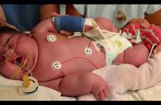 baby birth heaviest kgs weighing cesarean