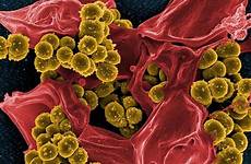bacterial toxins healing positive effect show bacteria toxin