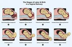 vaginal labor labour geburt vaginale lieferung arbeit stadien vaginalen reproductive arbeid geboorte stadia levering uterus consegna nascita fasi cervix rotation