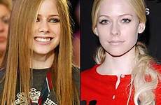 lavigne avril surgery plastic nose reported had has may