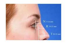 nasal projection ideal rhinoplasty radix nose nasion tip height natural defining point drsteiger