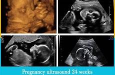 pregnancy 24 week weeks ultrasound 24th mother top