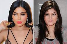 jenner kylie plastic surgery before transformation after body job looks surgeon boob