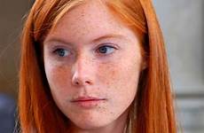 freckles redheads braces sommersprossen refrence tolle freckle mostly