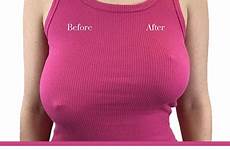 breast lifts surgical straps
