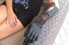 prosthetics prosthetic orthotics bionic castillo ivania amputee