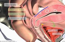uterus anatomy 3d reproductive
