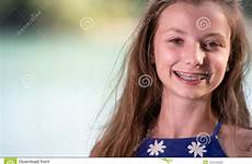 braces girl smiling teenage smile