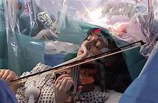 removal tumour tumore veniva suonato rimosso cervello violino musicista violinist