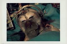 transplant monkey head robert brain surgery died decapitated human body monkeys he procedure onto pictured moved entire hour another which