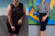 weight before after loss surgery los shoot soma bariatrics angeles goal hit once professional photographer learn ve