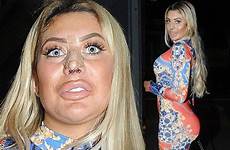 chloe ferry after bandaged nose boob job face ouch sports spending ireland straight single every latest very email