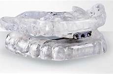 sleep apnea device tap appliance treatment vacaville dental berkeley