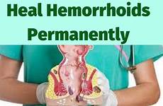 hemorrhoids causes symptoms