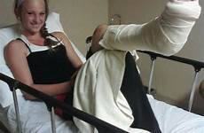 broken leg legs bella cast alexy foot documentary documentaries slc