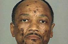 drug face man addicts meth heroin spots dark signs effects use abuse faces years after before side his features there