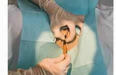 urethral catheter procedures urologic meatus lubricated