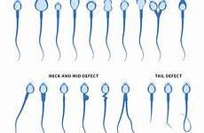 analysis semen sperm procedure count test results