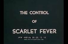scarlet fever treatment diagnosis