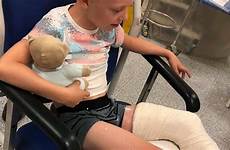 leg boy broken his lincolnshirelive josh