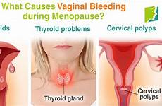 menopause bleeding vaginal abnormal thyroid problems