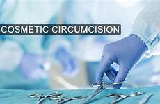 circumcision adult styles common procedure male style insight into asked questions frequently surgery under spread sexual