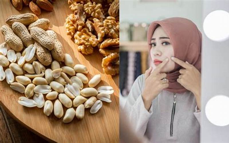 Apakah Banyak Makan Kacang Menimbulkan Jerawat?