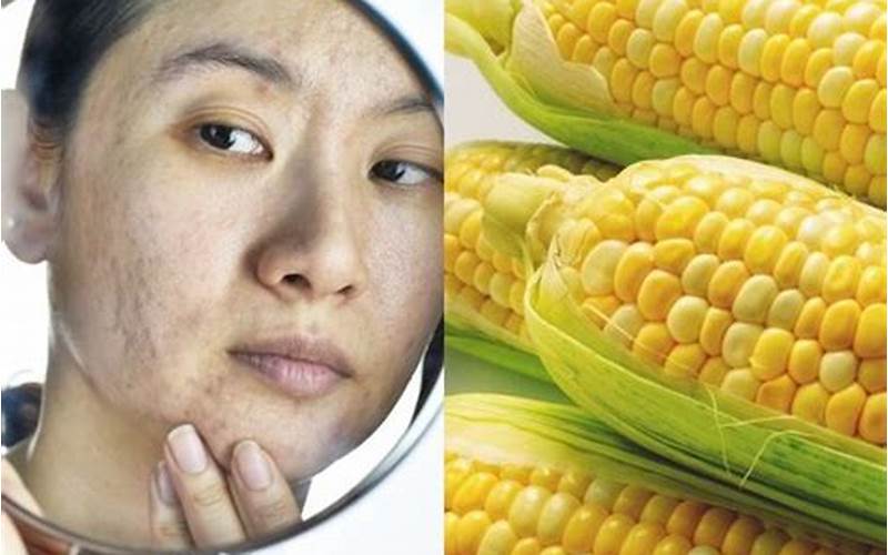 Apakah Jagung Bisa Menghilangkan Bekas Jerawat?